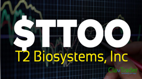 T2 Biosystems, Inc - TTOO Stock Chart Technical Analysis for 09-15-17